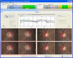 StereoPlus Extension Module